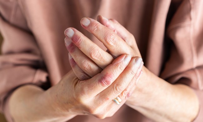 woman applying the best eczema lotion on dry skin